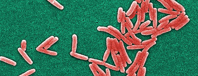 Deadly Legionnaire’s disease outbreak stopped by Xylem
